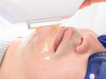 メンズ脱毛も大人気！ヒゲ脱毛も全身脱毛もお任せください☆