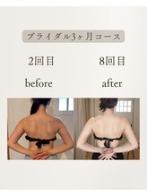 きぃ オリジンプラス(きぃ origin+)/ブライダル3ヶ月コース