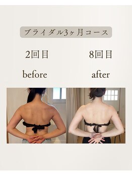 きぃ オリジンプラス(きぃ origin+)/ブライダル3ヶ月コース