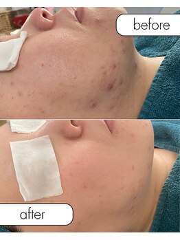 リノルーア(Linolua)/