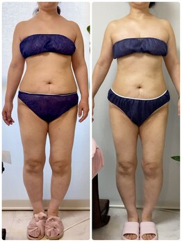 ペルラ(Perla)/お客様ビフォーアフター