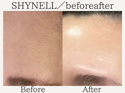 シャイネル(SHYNELL)の写真