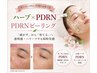 【韓国で話題の再生美容】PDRN×ハーブピーリングで輝く艶肌へ 80分 ￥6,600