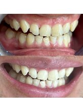 ライトビューティー 池袋店(LightBeauty)/症例写真