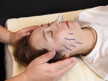 ケント鍼灸整骨院 整體院(KENT鍼灸整骨院 整體院)/美容鍼灸