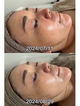 ナヴィータ アオバダイ(Navita AOBADAI)/エンビロン/2ヶ月４回