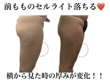 痩身革命 大宮店/1ヶ月4回の施術で結果をだす♪