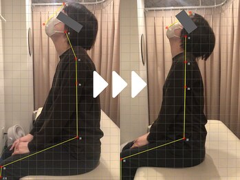 ミライズ整体院 三宮本院/事例【30代女性・首こり】