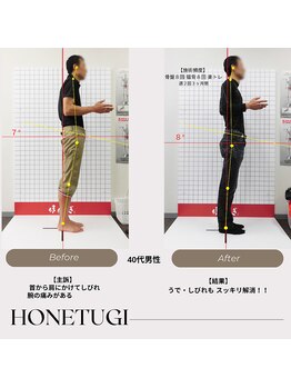 ほねつぎ総社 はりきゅう接骨院/成果/首からのしびれ感