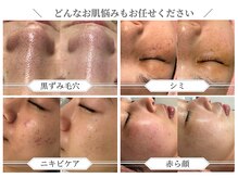 ベストベル(BestBelle)の雰囲気（様々なお肌悩みに特化したメニューを多数ご用意しております◎）