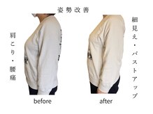 リセットモア(Reset More)/細みえ効果・姿勢改善