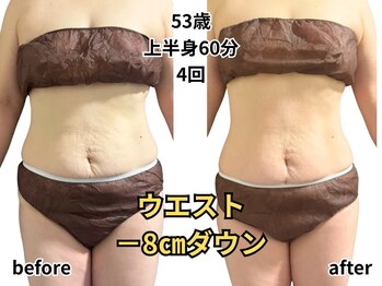アルピナ(ALPINA)/お腹周りサイズダウン例