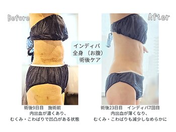 カリド ラボ(CALIDO LAB)の写真/《術後ケア◎》美容施術後などのダウンタイムで気になる痣・むくみやこう縮に特化し深部まで届く最新機ケア