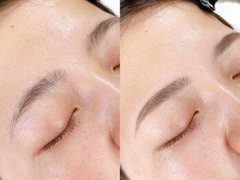 ホワイトアイ 武蔵小杉2号店(WHITE EYE)の写真/美眉アイブロウWAX+フェイシャルWAX¥4980~★汚れや古い角質をしっかり落としトーンUP!!