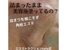 アイシェリー(eyecherie)/毛穴エクストラクション