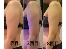 クレアボディ(CREA BODY)/二の腕