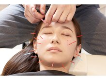 前橋miraie鍼灸整骨院(前橋ミライエ鍼灸整骨院)/施術風景[整体/小顔/前橋/群馬]