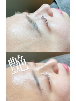 ブラジリアンワックス専門店 アンジー(ANGIE)/フェイスワックス