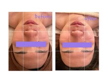 モーンガータ(mangata)/《BeforeAfter》