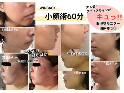 ナニワ ビューティー(naniwa beauty)の写真