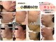 ナニワ ビューティー(naniwa beauty)の写真