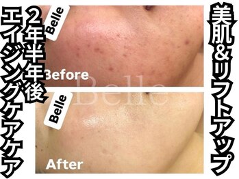 ベル 南船場店(Belle)/エイジングケアもお任せ下さい!