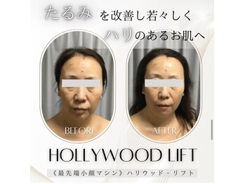 ブリリオプラス 四条烏丸店(Brillio plus)/ハリウッドリフト