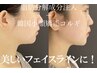 No3【脂肪分解＋美肌+小顔】レモンボトル2倍+韓国ララピール+コルギ14400円