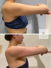 エムクリニカルラボ 藤沢(M clinical lab)/脂肪燃焼剤導入×痩身エステ