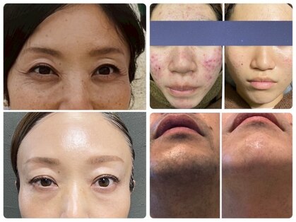 エクシア(excia)の写真