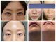 エクシア(excia)の写真