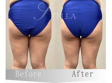 ステラ(STELLA)/下半身スタンダードの効果