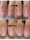 続けるごとに爪の形が変わる!