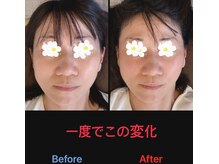 美容矯正サロン レレポノ(LELEPONO)/