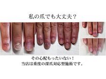 ご不安な方は、無料カウンセリングにてお問い合わせも可能！