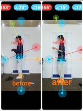 若松整体院若林区院/猫背矯正ビフォーアフター☆