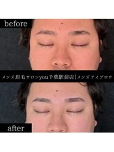 ユー 千葉駅前店(you)/ビフォ－アフター写真
