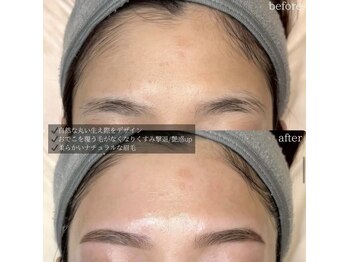 モーント 南森町店(Mond)の写真/フェイシャルWAXはただの脱毛ではなく、お肌の土台を整える月に一回のフェイシャルトリートメント★