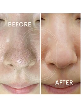 肌屋(HADA-YA)/毛穴リメイク+水光セル