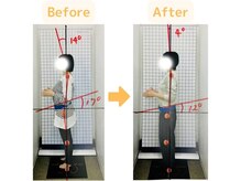 藤接骨院 浜松東院/腰痛を産後骨盤矯正で改善♪