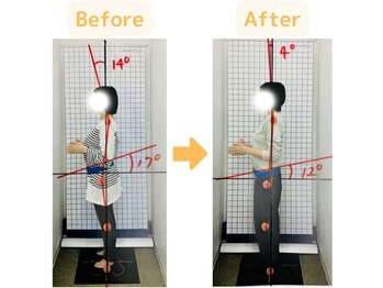 藤接骨院 浜松東院/腰痛を産後骨盤矯正で改善♪