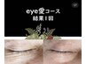 目の悩み 眼精疲労eye愛コース