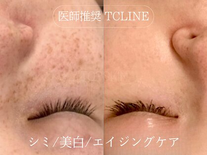 トップスキン 栄(TOPSKIN)の写真