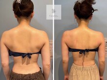 エムクリニカルラボ 藤沢(M clinical lab)/脂肪燃焼剤導入×痩身マシン