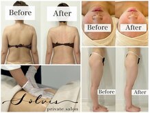 ソルヴィス(SOLVIS)