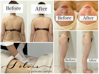 ソルヴィス(SOLVIS)の写真