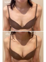 プリマベラ 花隈店(Primabella)/バストアップ☆ビフォーアフター