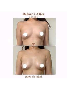 サロン ド ミミ(salon de mimi)/バストアップBeforeAfter