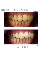 エンルーチェ プラスエイト(en;Luce+8)/医ホワイトニング