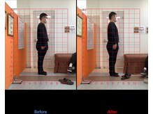 ゼロヒャク整骨院(ZERO100整骨院)/猫背矯正×骨盤矯正